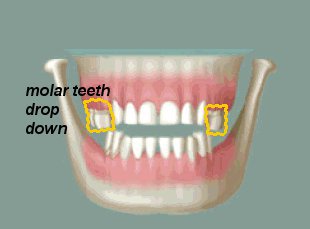 molar drop